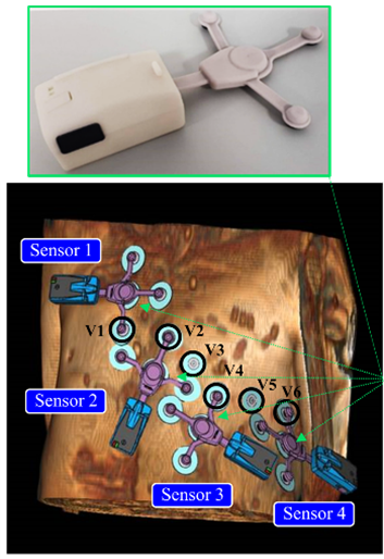 Capteur ECG compatible IRM développé avec la société Schiller