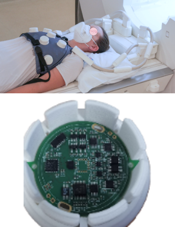 12-lead ECG reconstructed from 4 MRI-compatible sensors (left) and MRI ECG denoising (right)