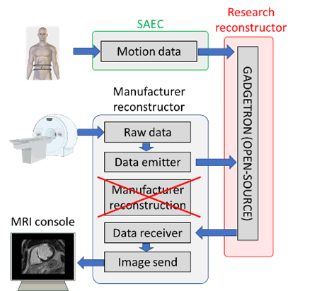 Real-time image reconstruction system for routine clinical use